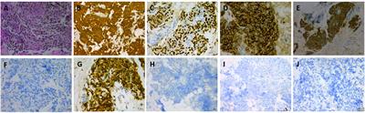 Case report: A sustained survival benefit of third-line immunotherapy for refractory thymic carcinoma